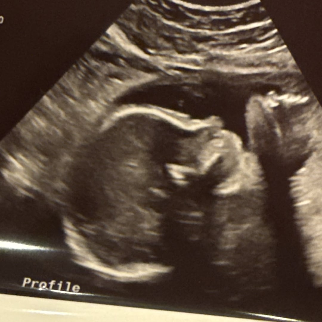 Photo shared by Abigail for their Babylist baby registry.