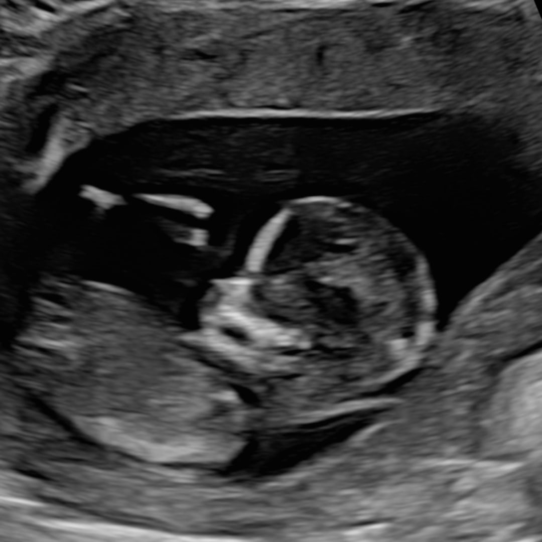 Photo shared by Casey for their Babylist baby registry.