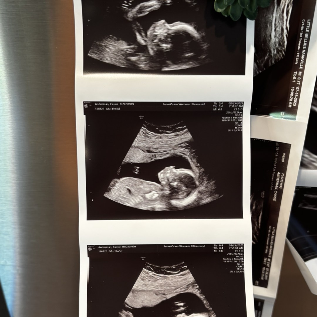 Photo shared by Cassie for their Babylist baby registry.