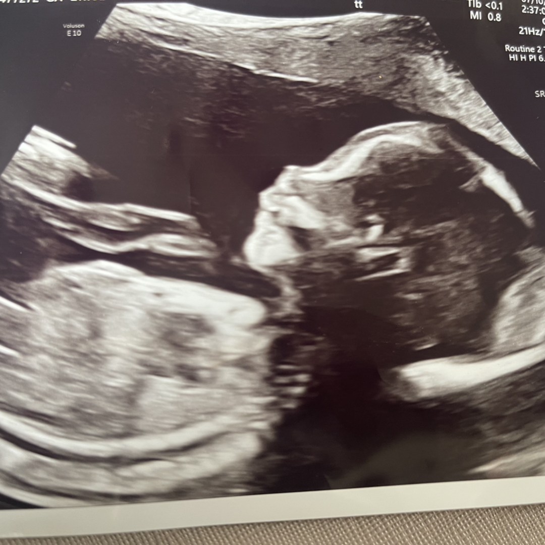 Photo shared by Dennis for their Babylist baby registry.