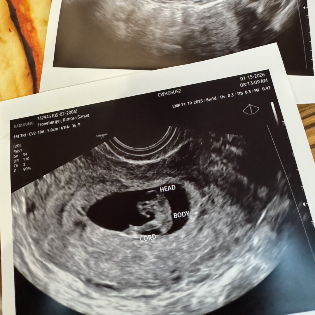 Photo shared by Kimora for their Babylist baby registry.