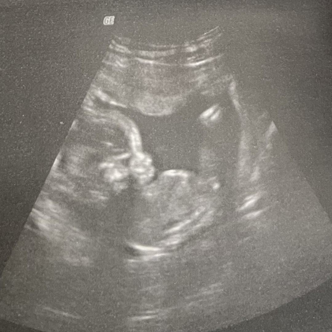 Photo shared by Justice for their Babylist baby registry.