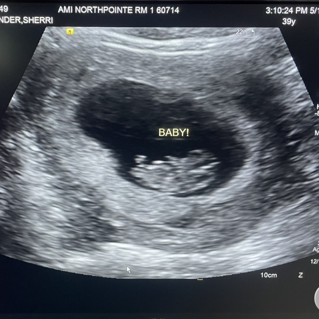 Photo shared by Sherri for their Babylist baby registry.