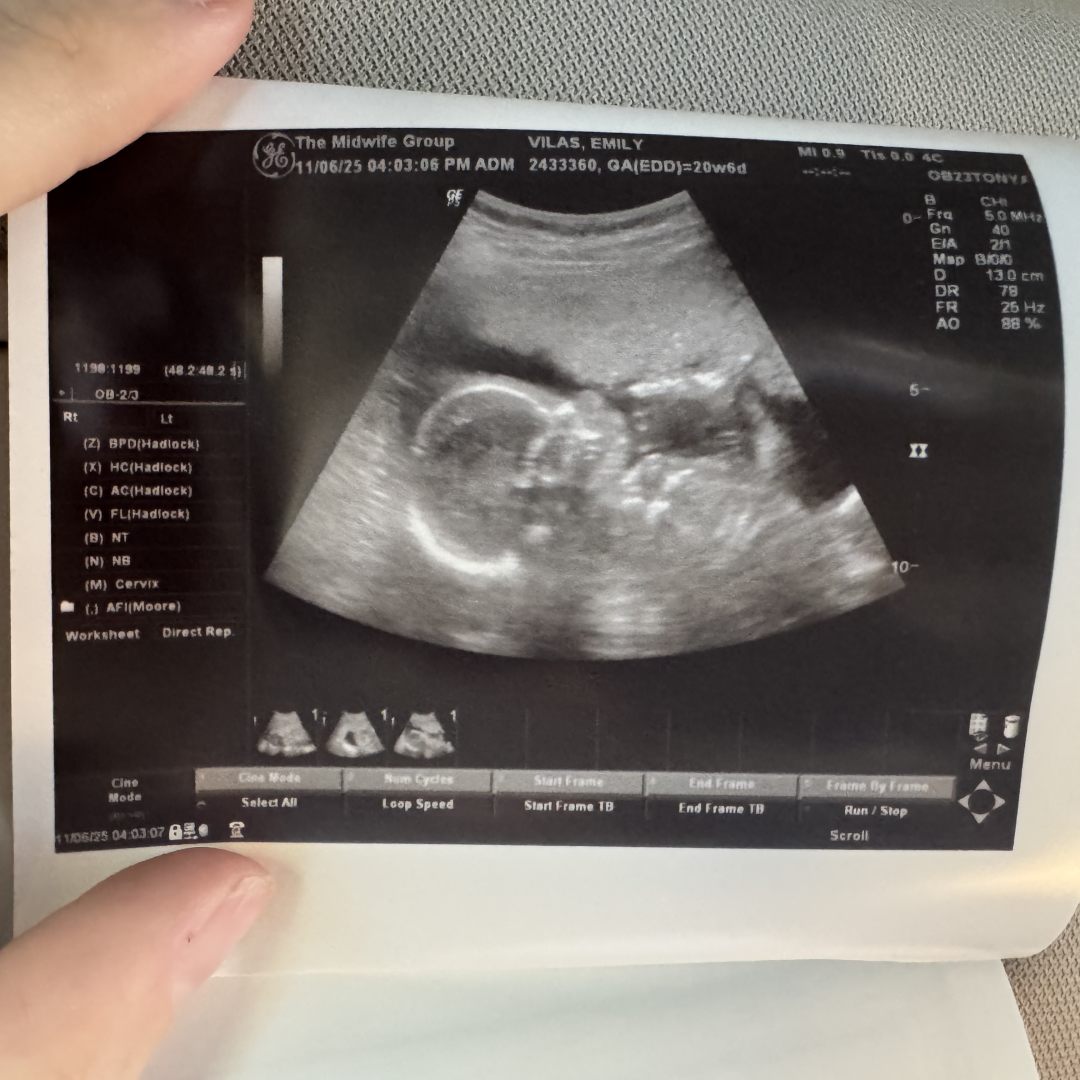 Photo shared by Emily for their Babylist baby registry.