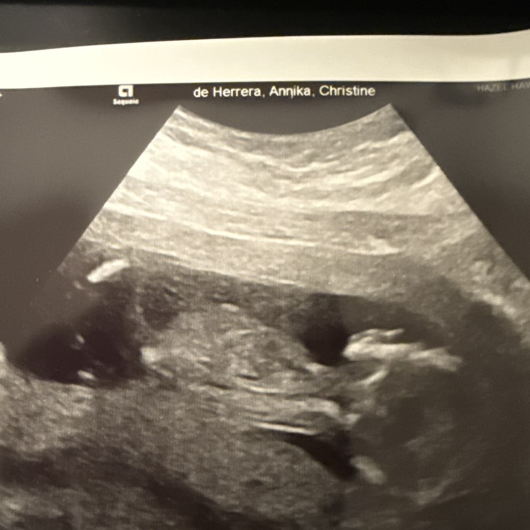 Photo shared by Annika for their Babylist baby registry.