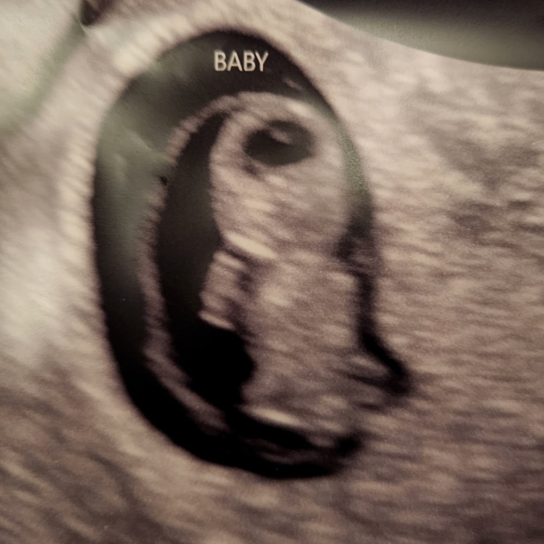Photo shared by Nikki for their Babylist baby registry.