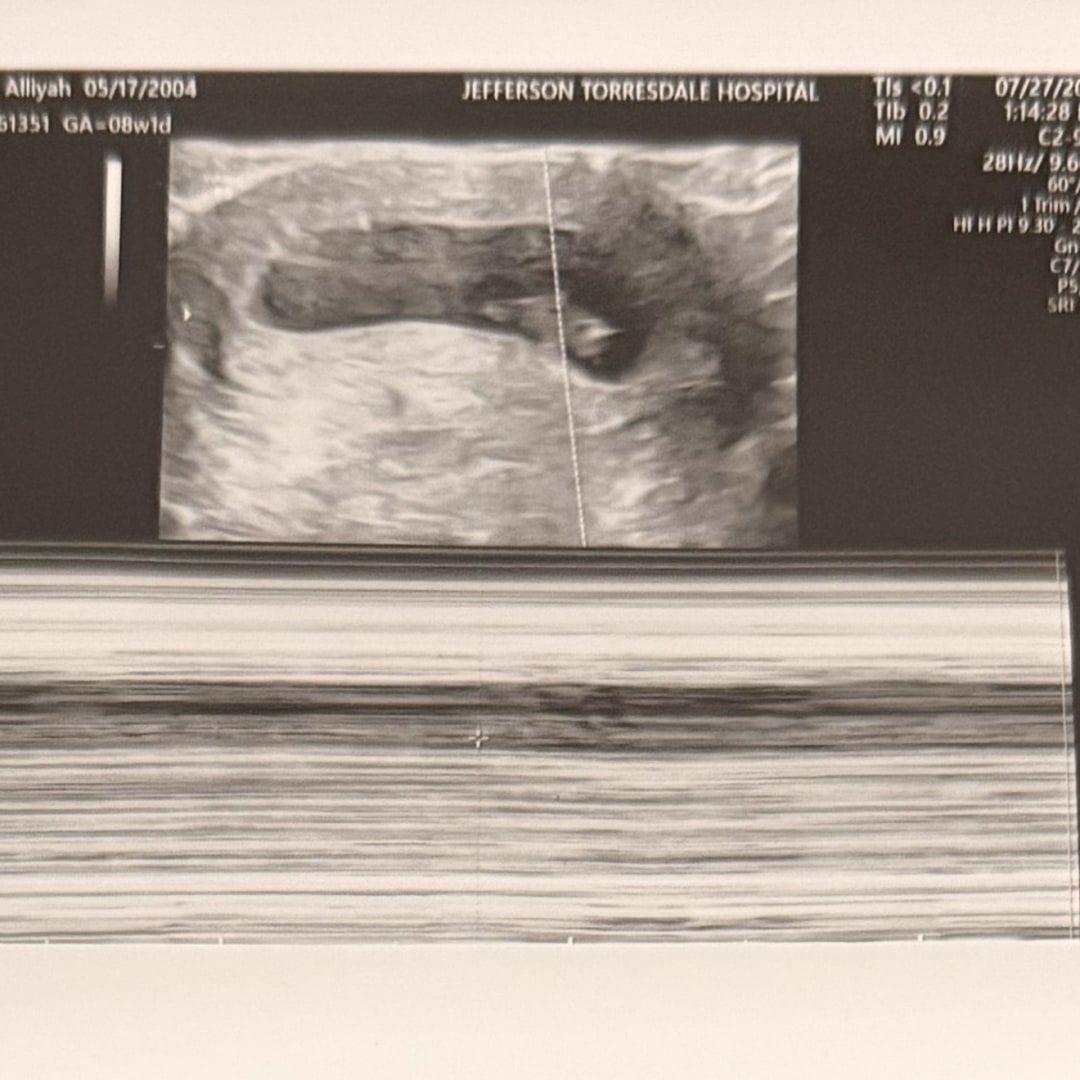 Photo shared by Alliyah for their Babylist baby registry.