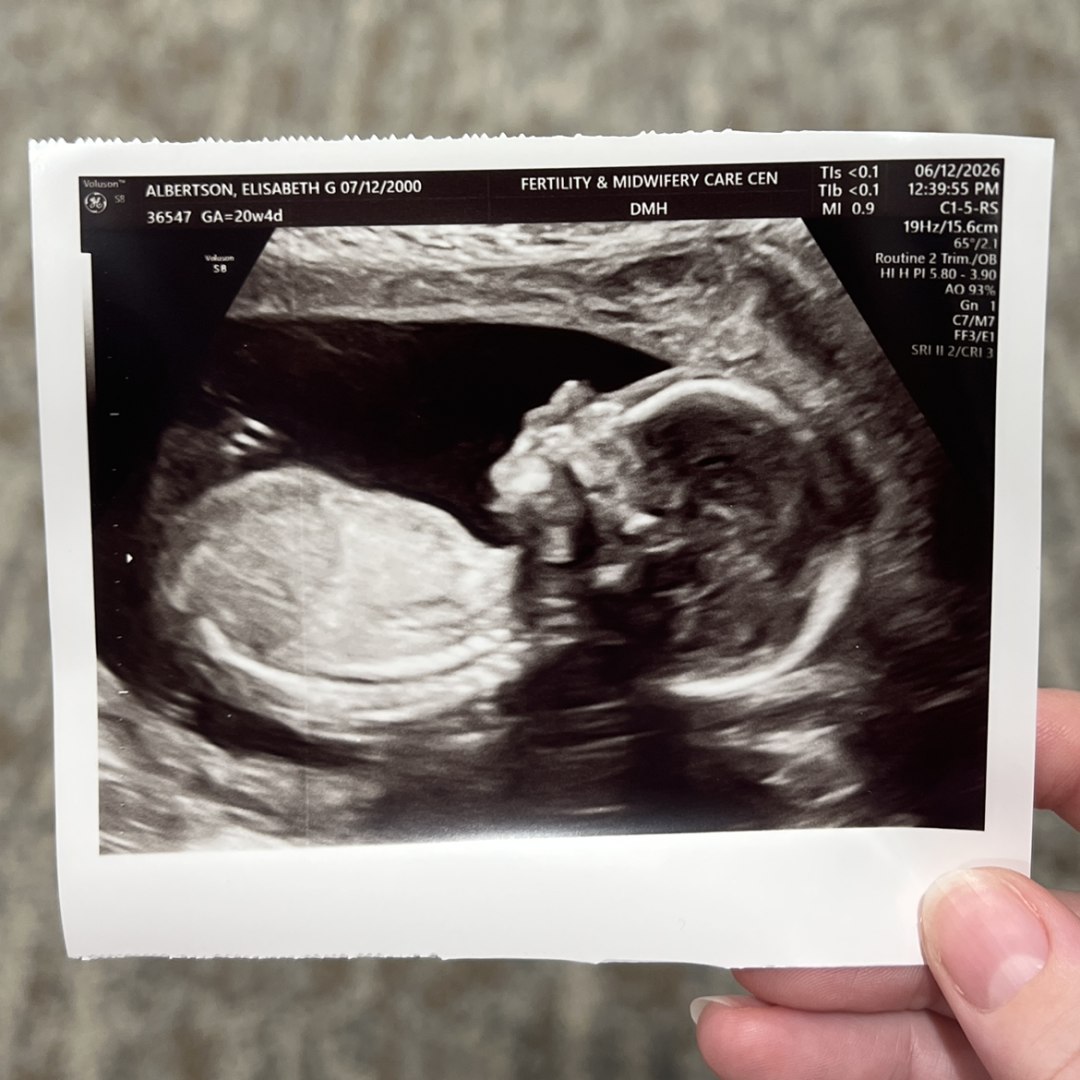Photo shared by Elisabeth for their Babylist baby registry.