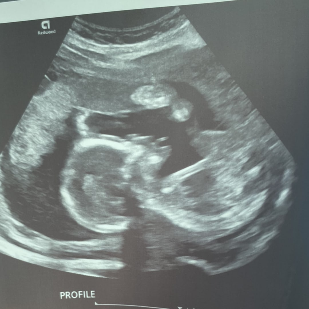 Photo shared by Tamya for their Babylist baby registry.