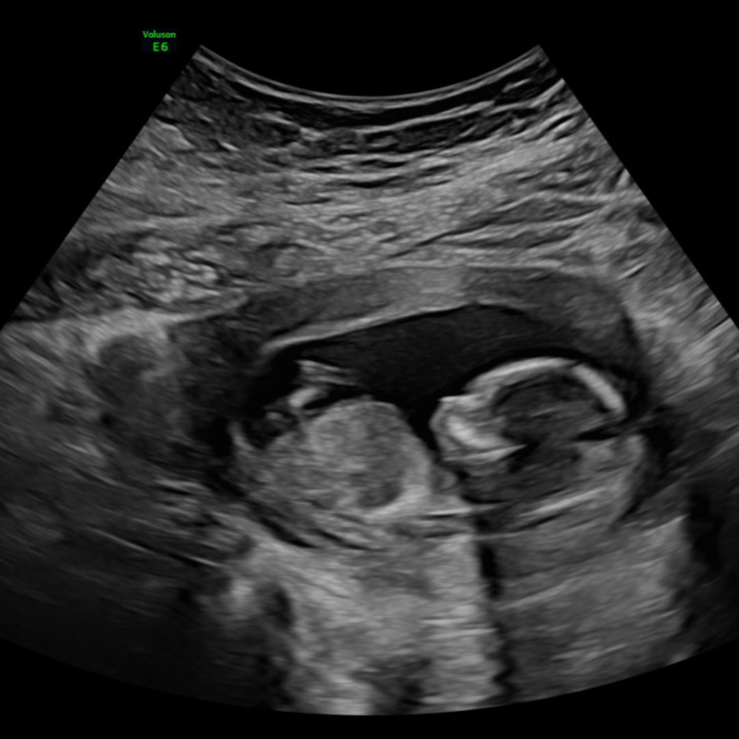 Photo shared by Lizz for their Babylist baby registry.