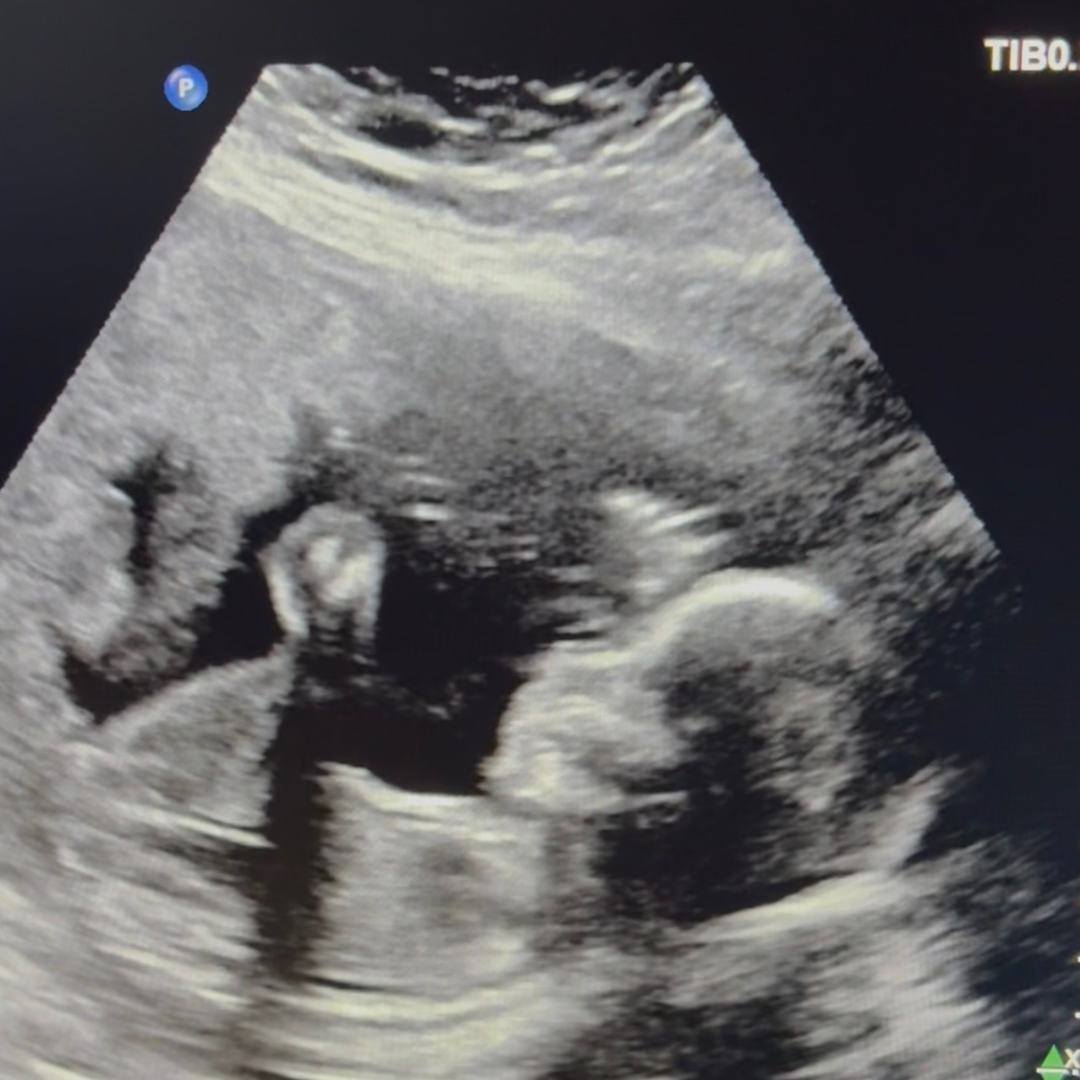 Photo shared by Sarah for their Babylist baby registry.