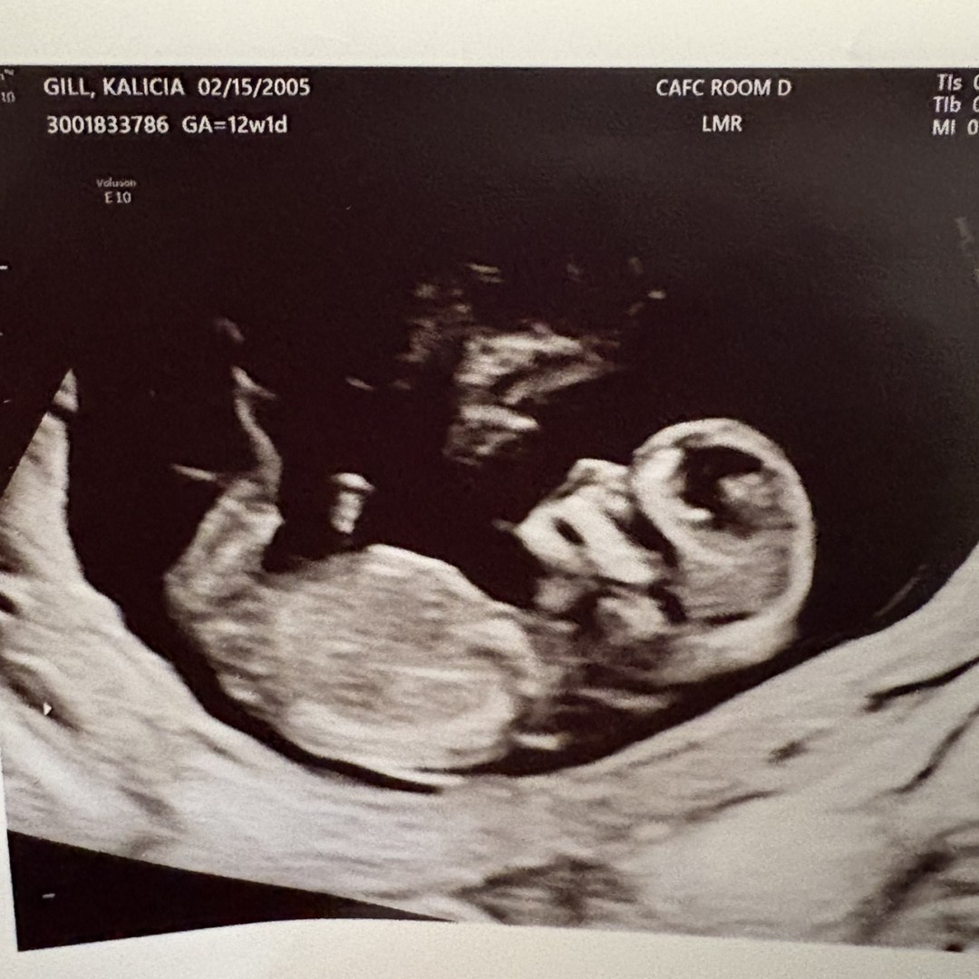Photo shared by Kalicia for their Babylist baby registry.
