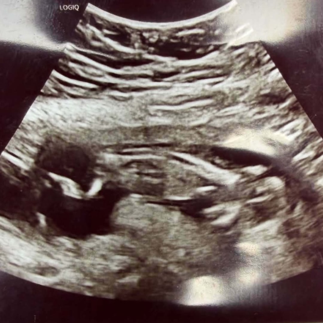 Photo shared by Cassandra for their Babylist baby registry.