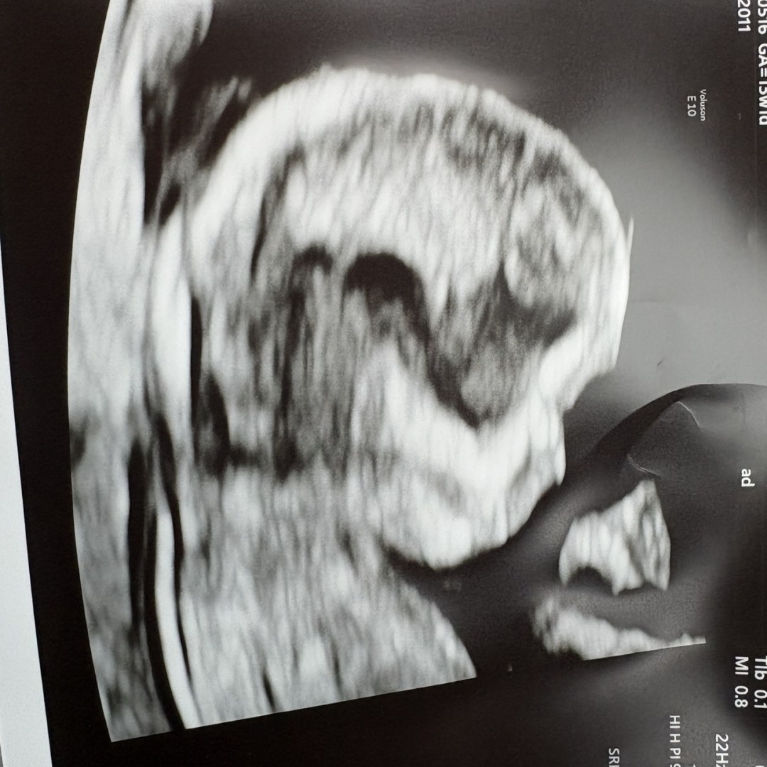 Photo shared by Katja for their Babylist baby registry.