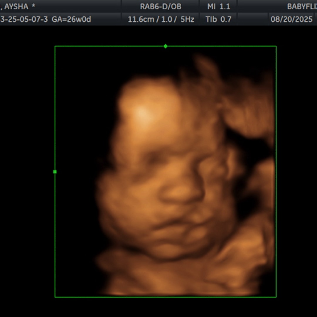 Photo shared by Aysha for their Babylist baby registry.