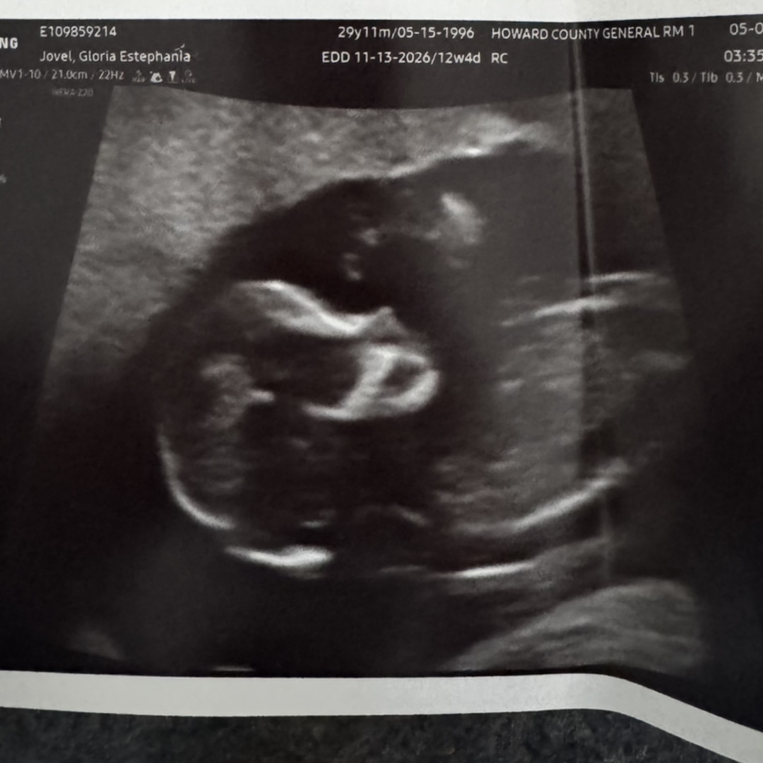 Photo shared by Gloria for their Babylist baby registry.