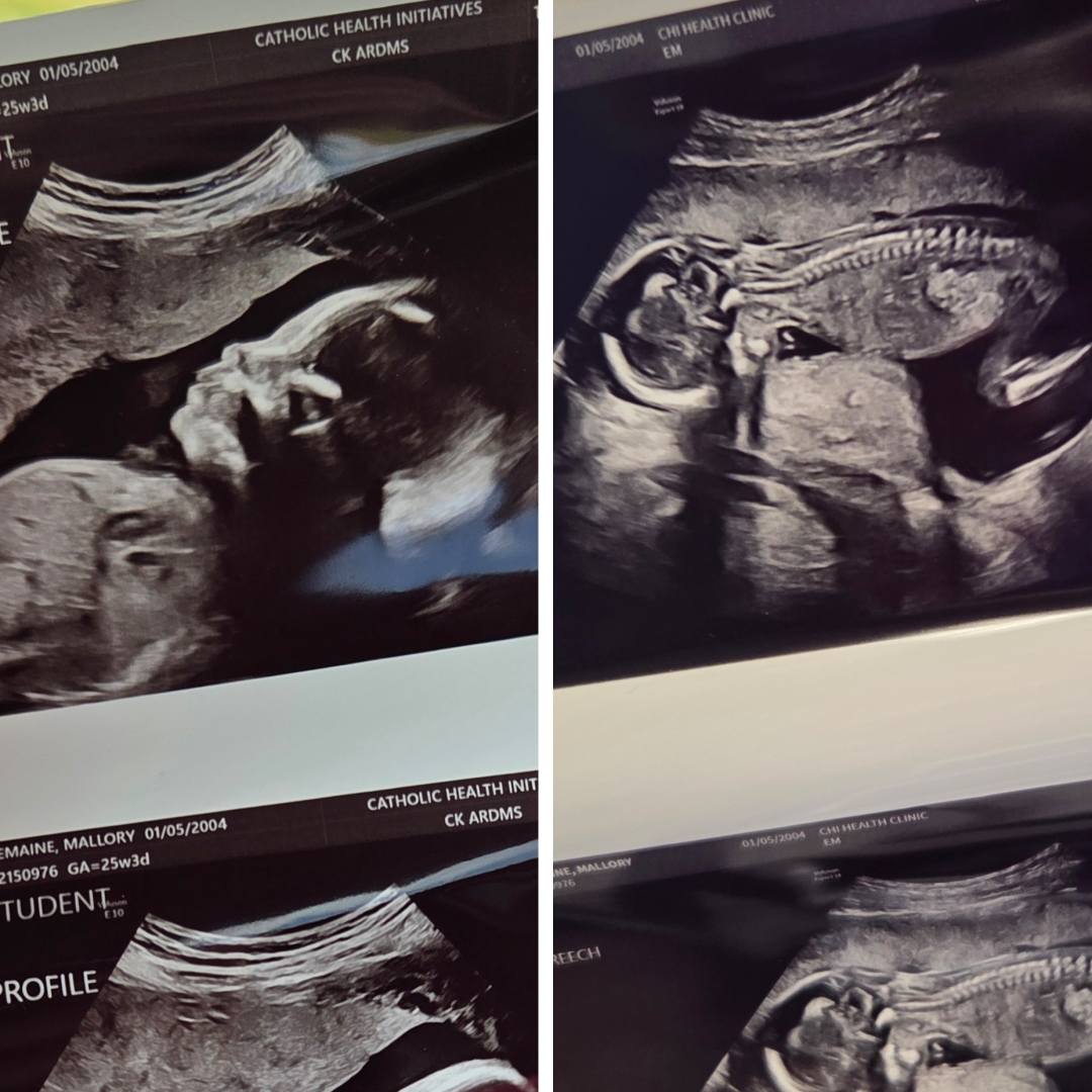 Photo shared by Mallory for their Babylist baby registry.