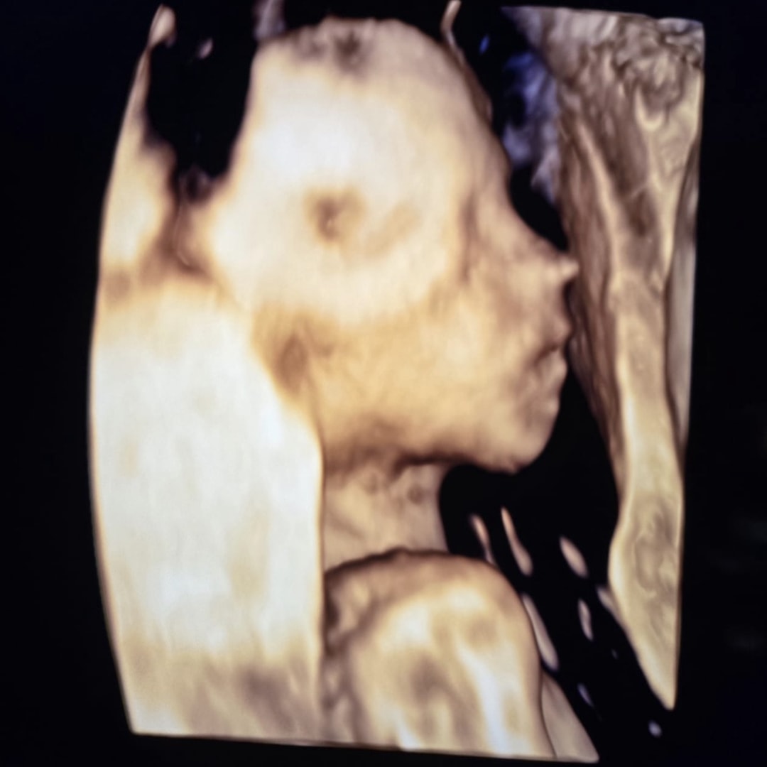 Photo shared by Katherine for their Babylist baby registry.