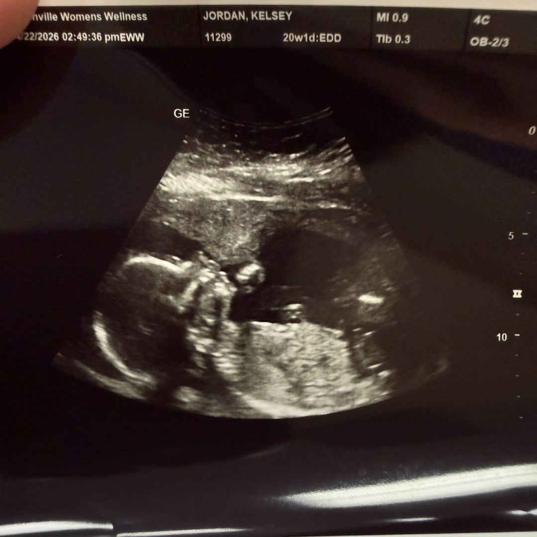 Photo shared by Kelsey for their Babylist baby registry.