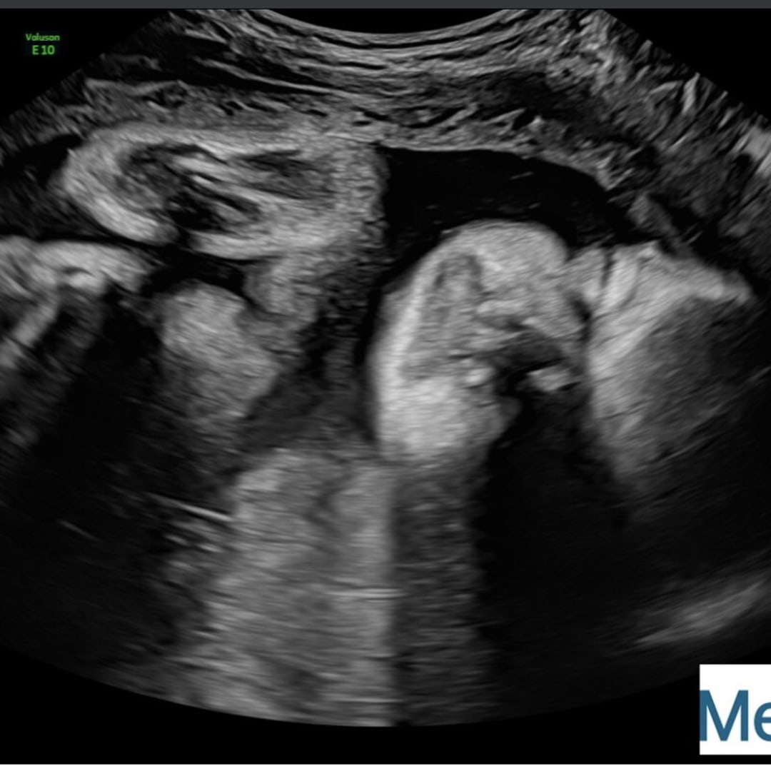 Photo shared by Deborah for their Babylist baby registry.