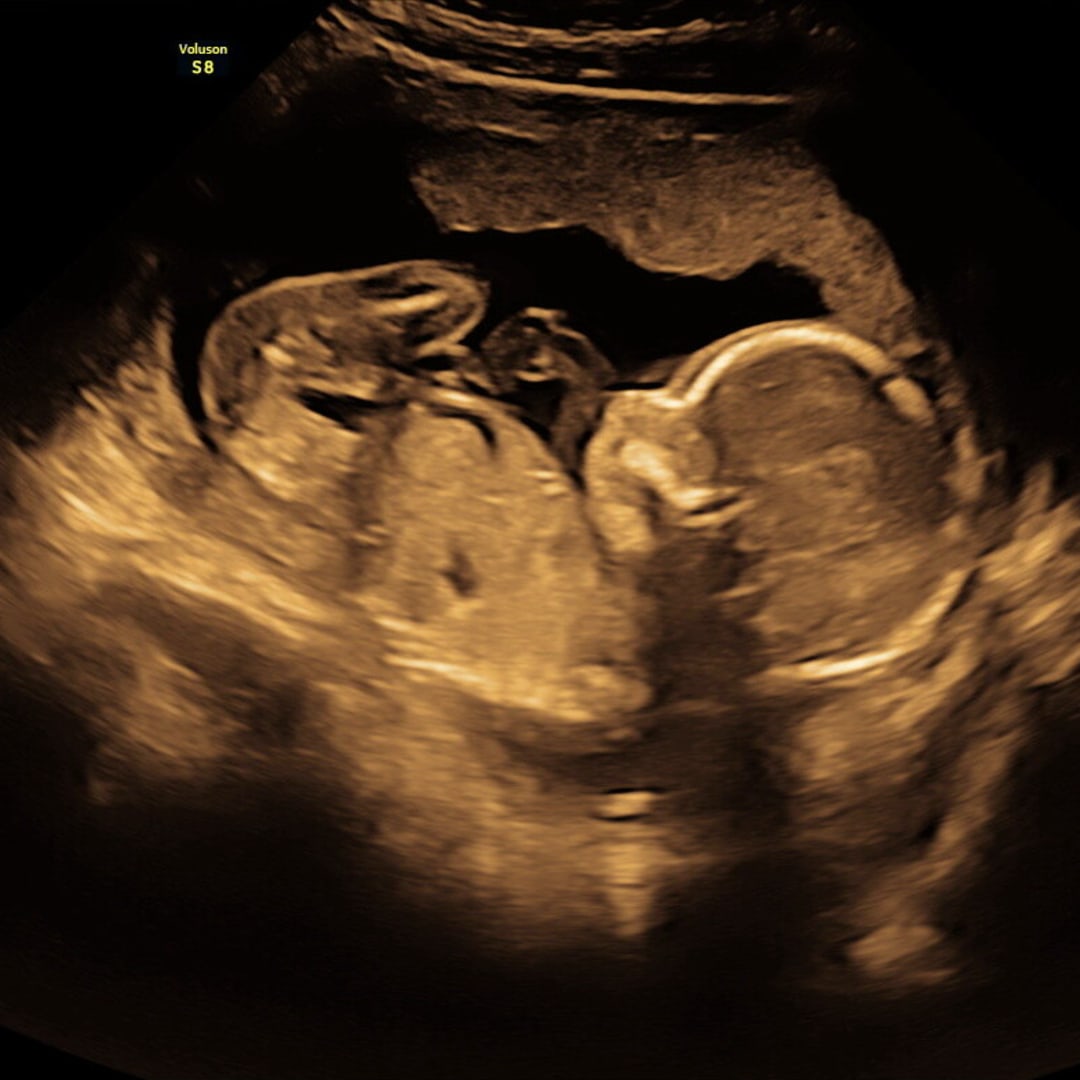 Photo shared by Rebekah for their Babylist baby registry.