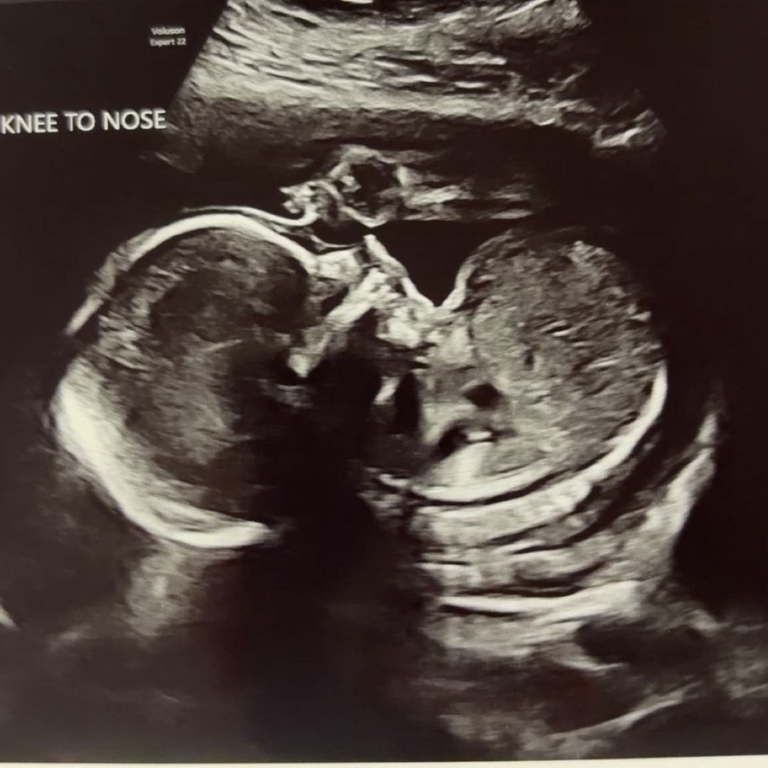 Photo shared by Mary for their Babylist baby registry.