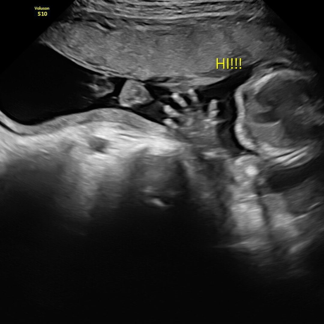 Photo shared by Halli for their Babylist baby registry.