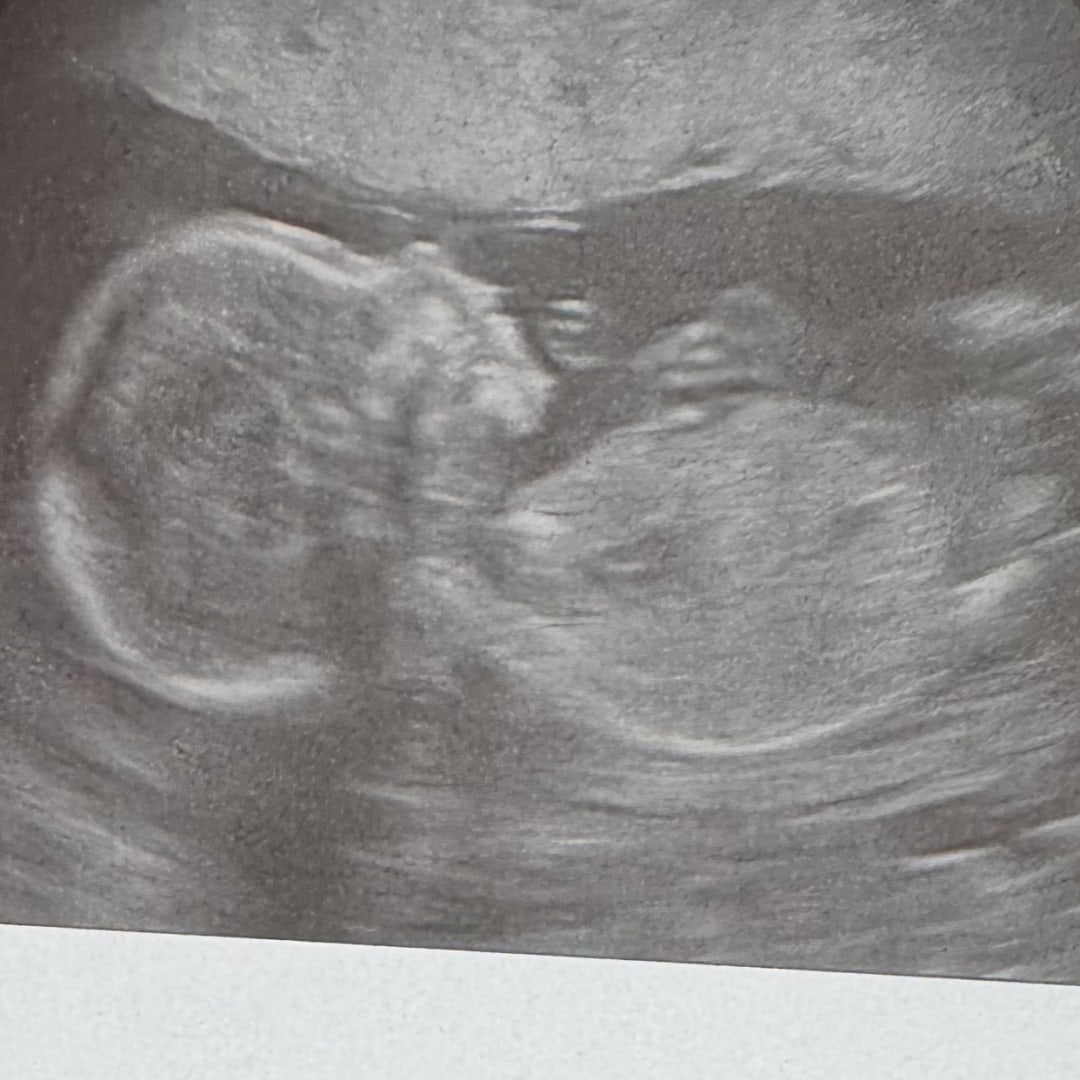 Photo shared by Kaleagh for their Babylist baby registry.