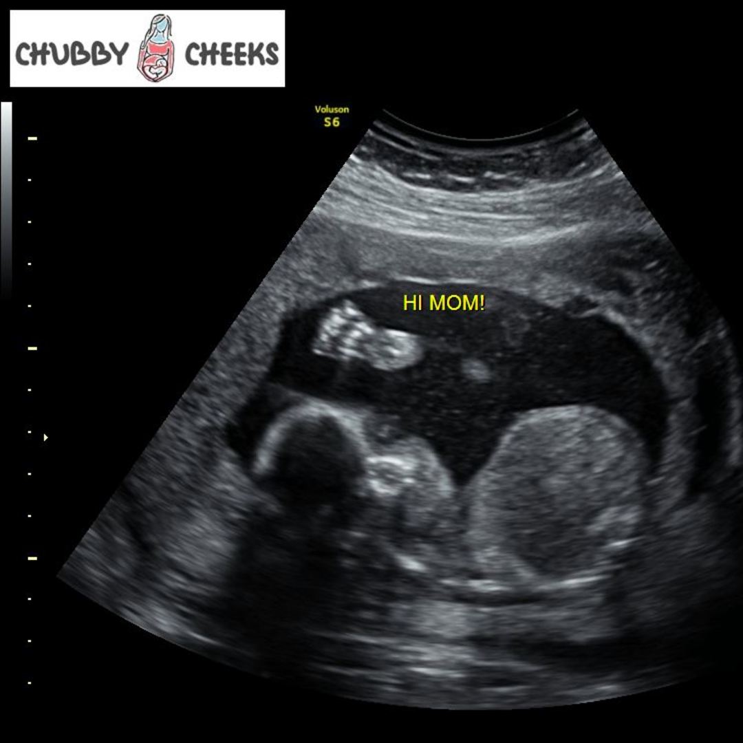 Photo shared by Jillique for their Babylist baby registry.