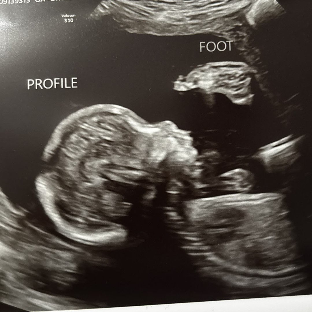 Photo shared by Myra Tatum for their Babylist baby registry.