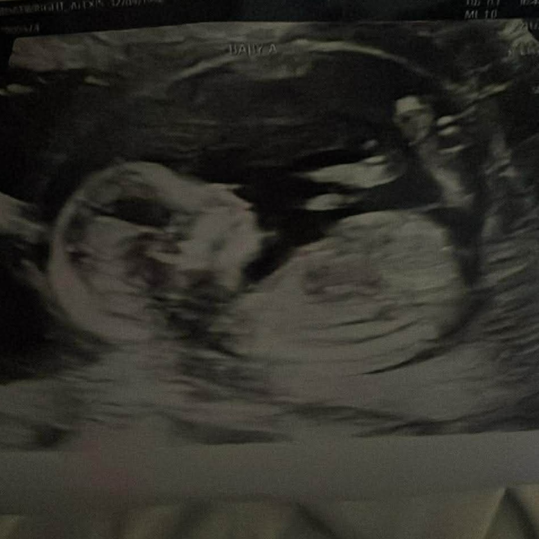 Photo shared by Alexis for their Babylist baby registry.