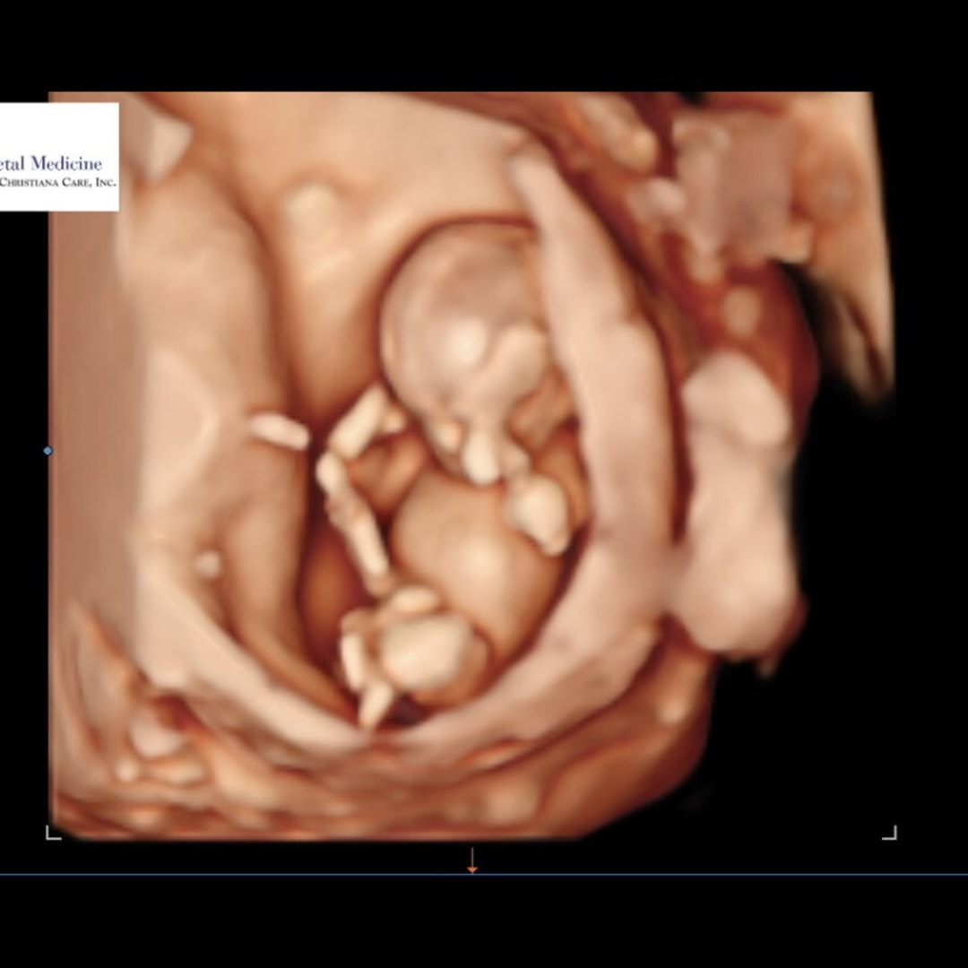 Photo shared by Madison for their Babylist baby registry.