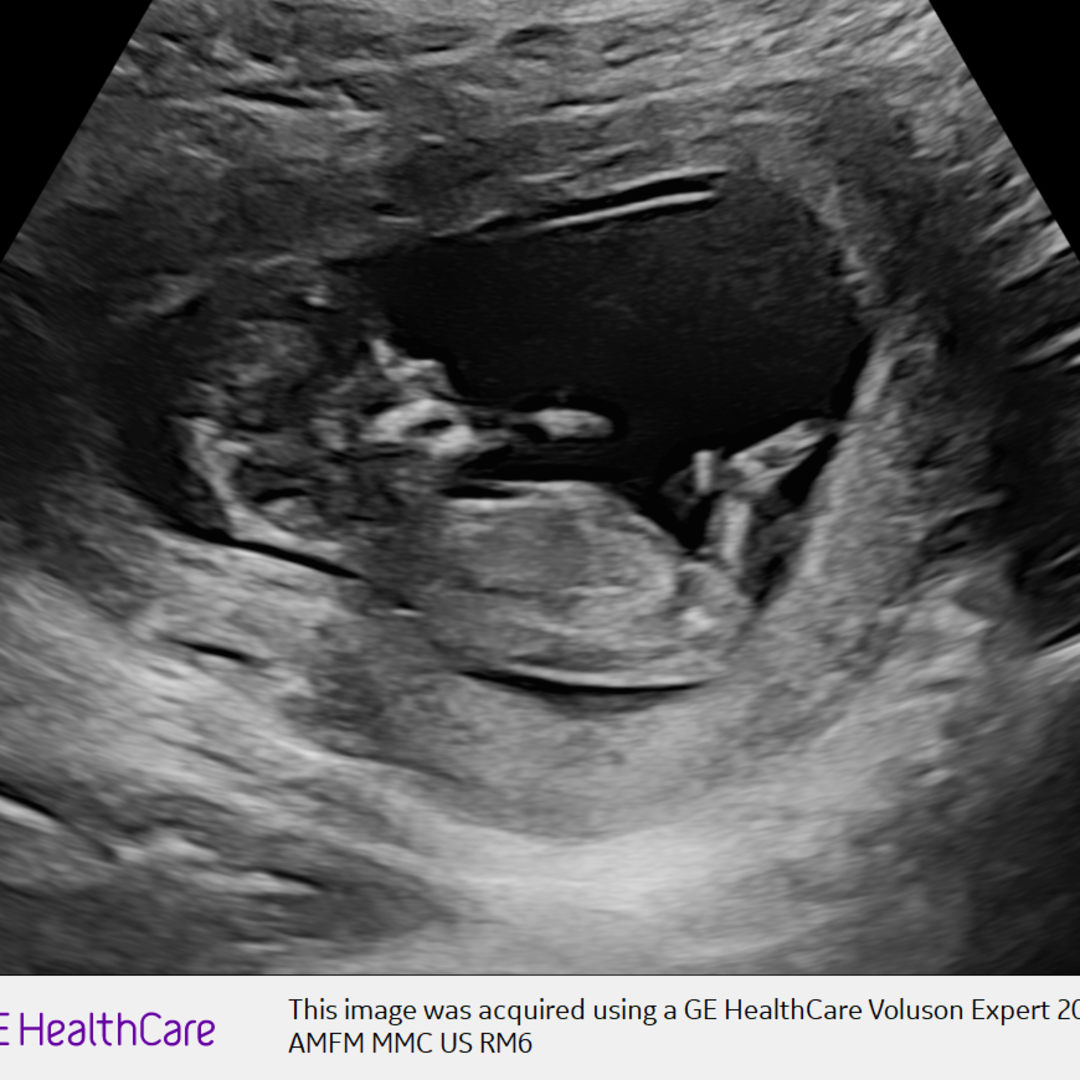 Photo shared by Tania for their Babylist baby registry.