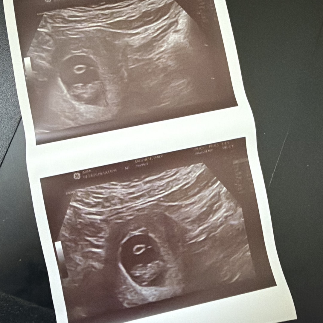 Photo shared by Emily for their Babylist baby registry.