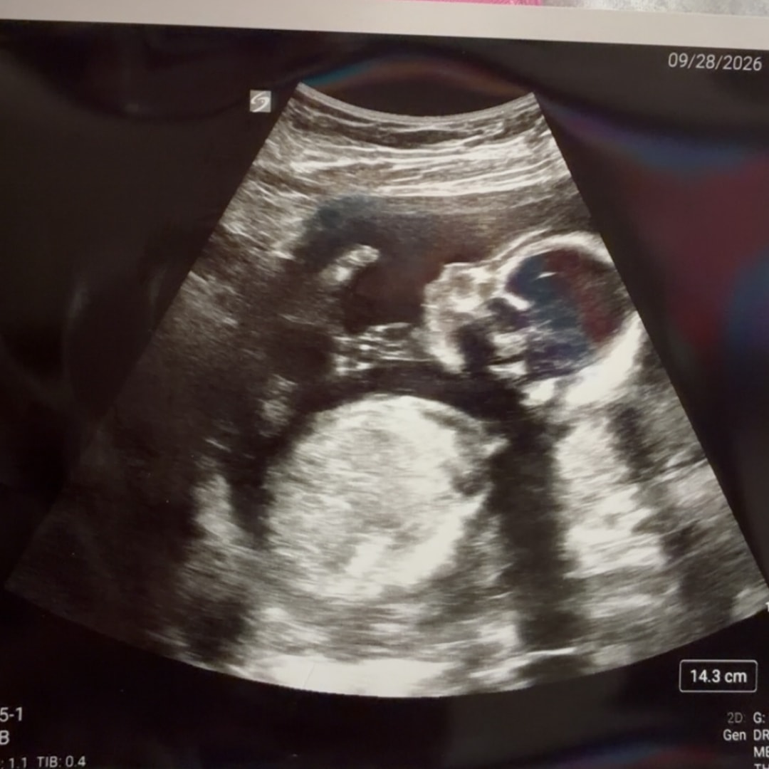 Photo shared by Chloe for their Babylist baby registry.