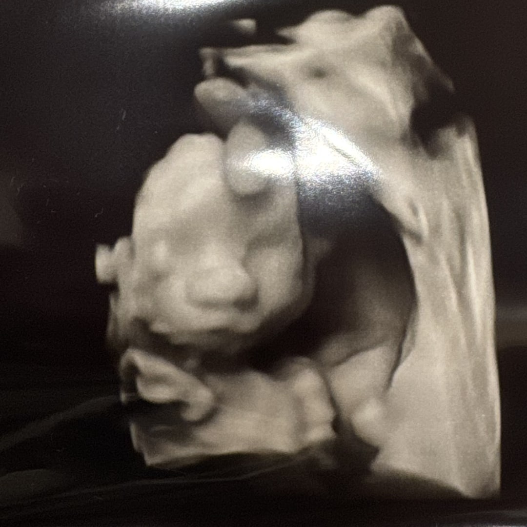 Photo shared by Ally for their Babylist baby registry.