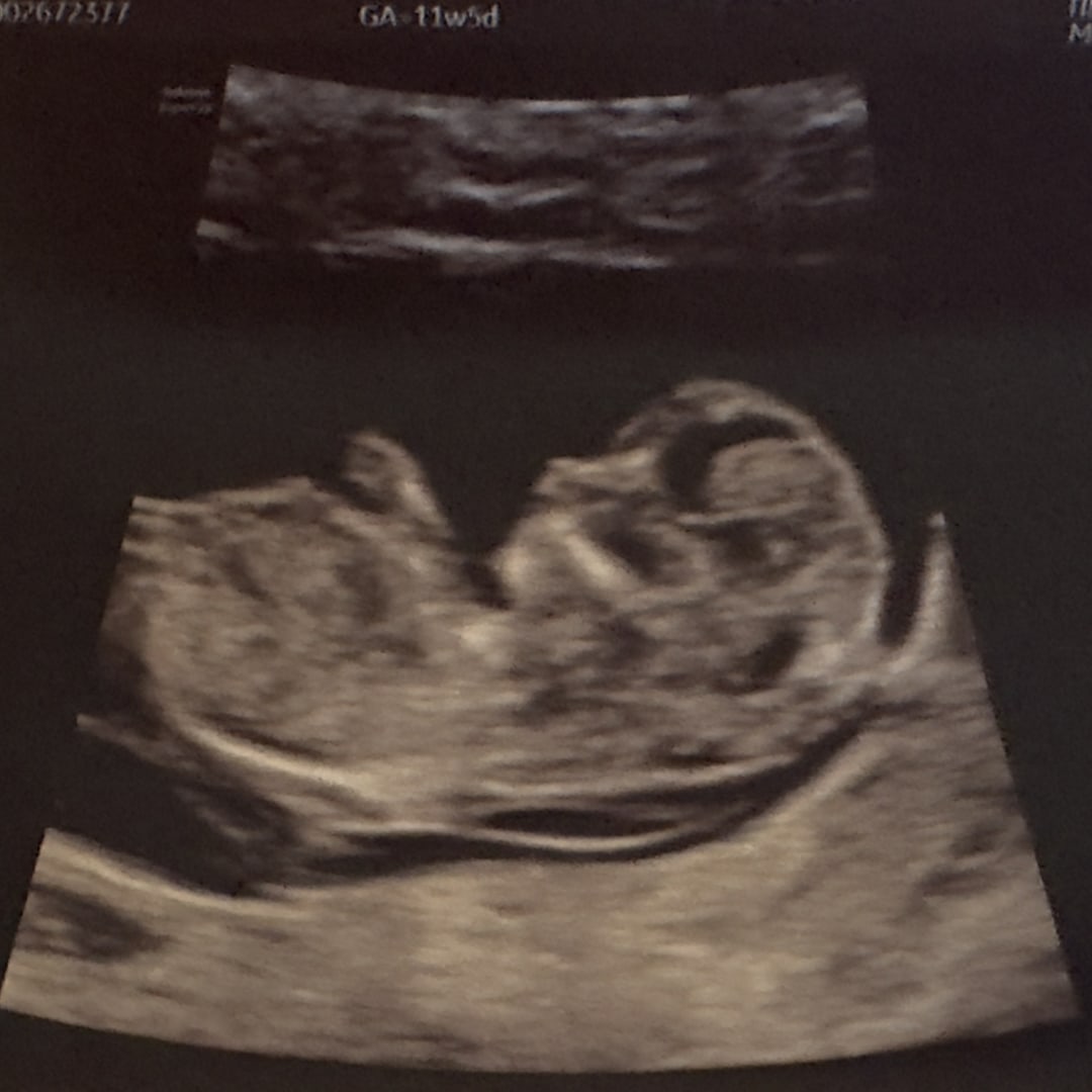 Photo shared by Laura for their Babylist baby registry.