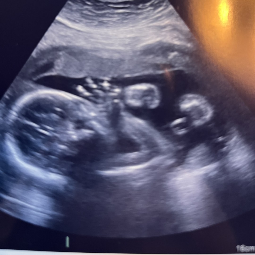 Photo shared by Allison for their Babylist baby registry.