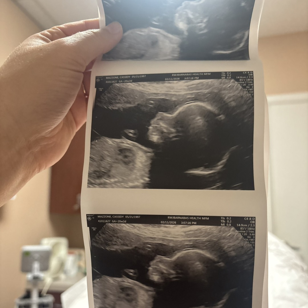 Photo shared by Cassidy for their Babylist baby registry.