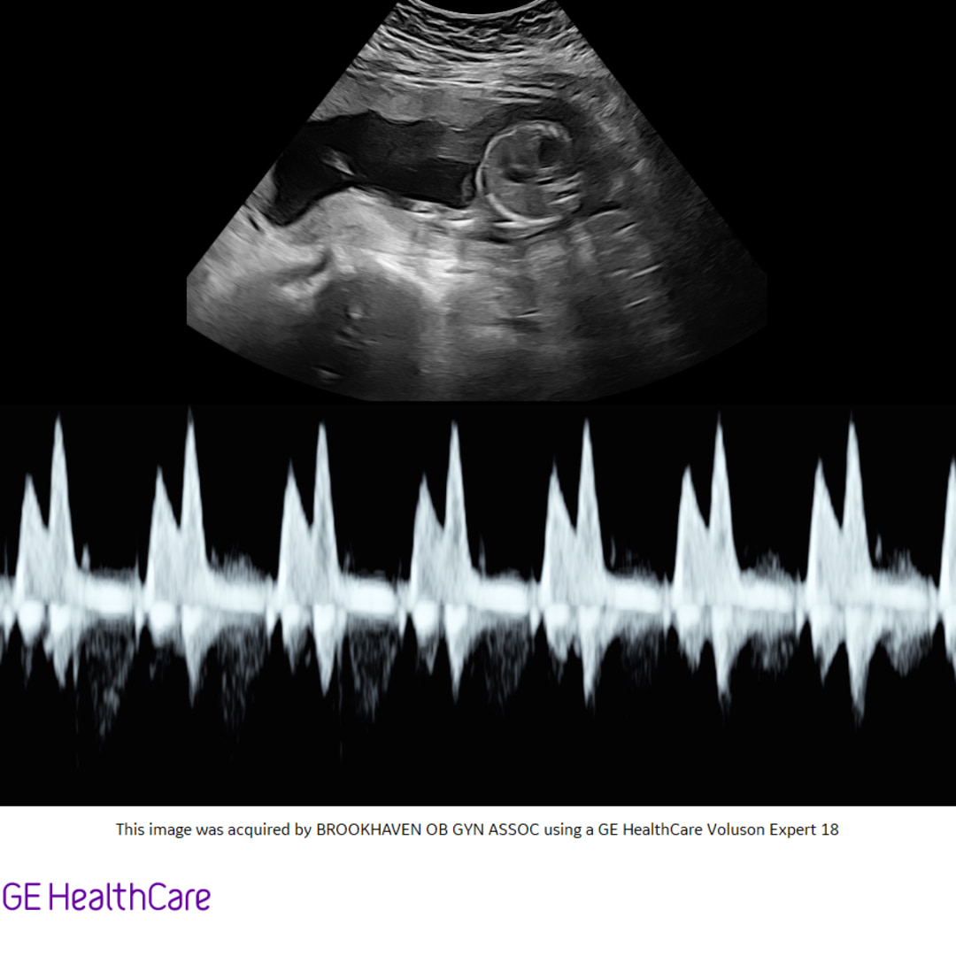 Photo shared by Alyssa for their Babylist baby registry.