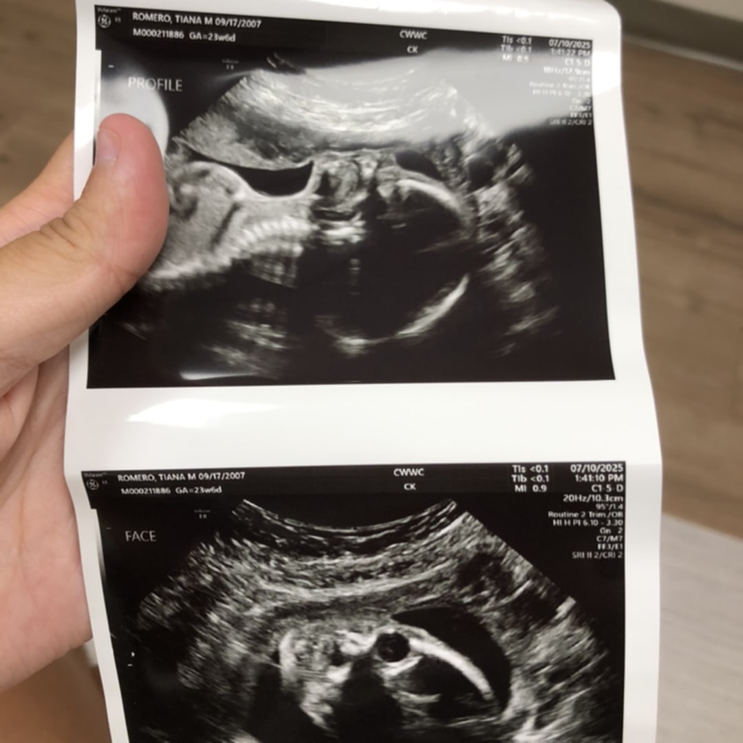 Photo shared by Tiana for their Babylist baby registry.