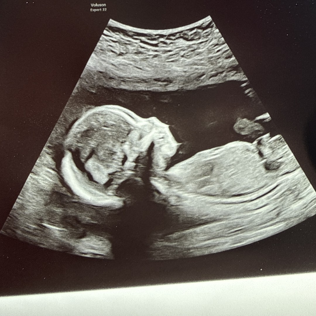 Photo shared by Lauren for their Babylist baby registry.