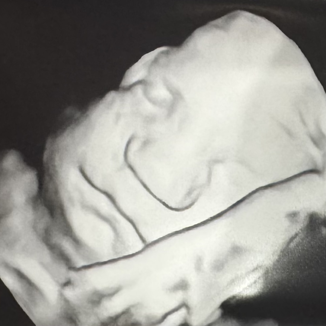 Photo shared by Emily for their Babylist baby registry.