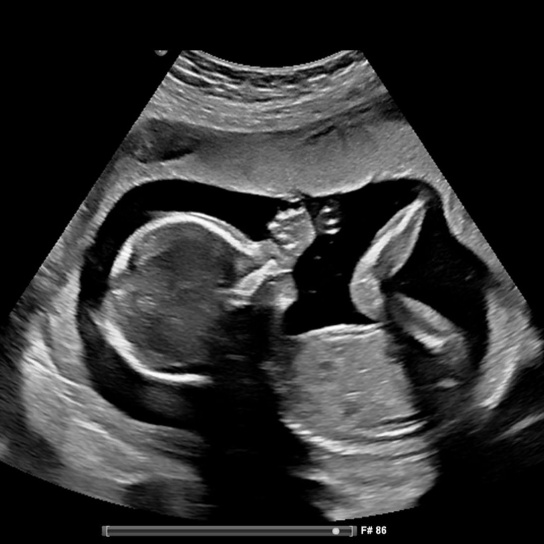 Photo shared by Veronica for their Babylist baby registry.