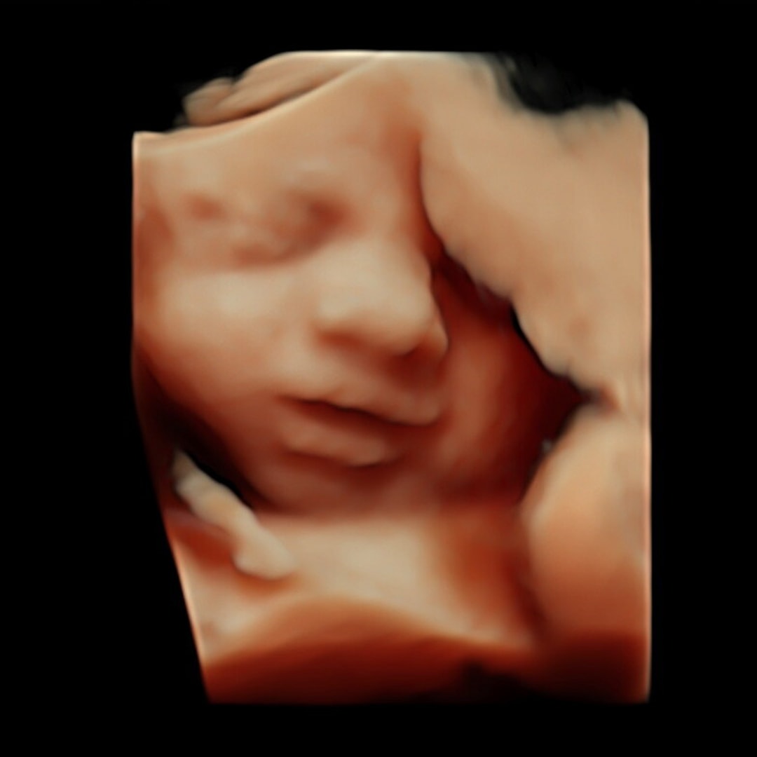 Photo shared by Alexis for their Babylist baby registry.