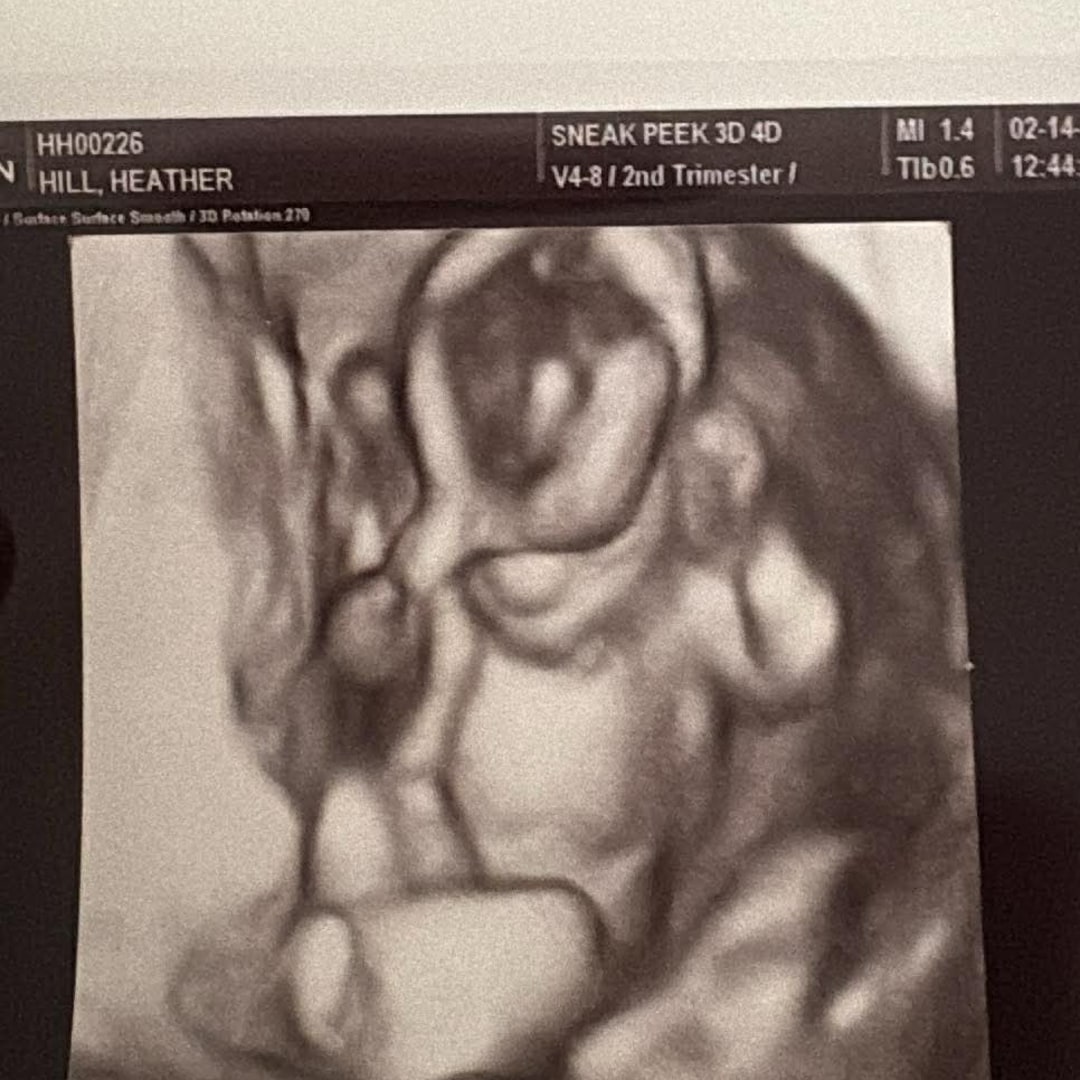 Photo shared by Heather for their Babylist baby registry.