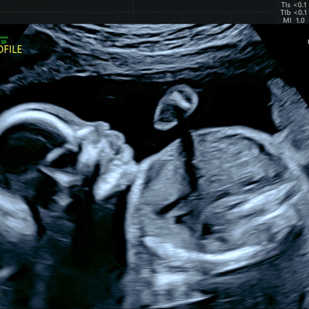 Photo shared by Amy for their Babylist baby registry.