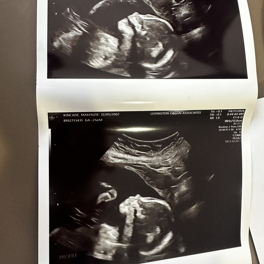 Photo shared by Makenzie for their Babylist baby registry.