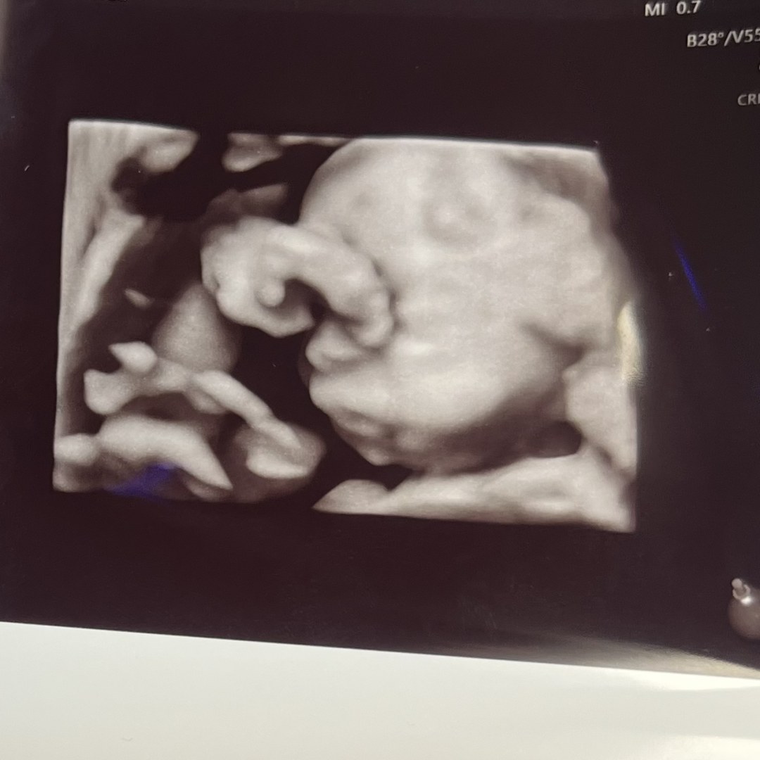 Photo shared by Chicka for their Babylist baby registry.