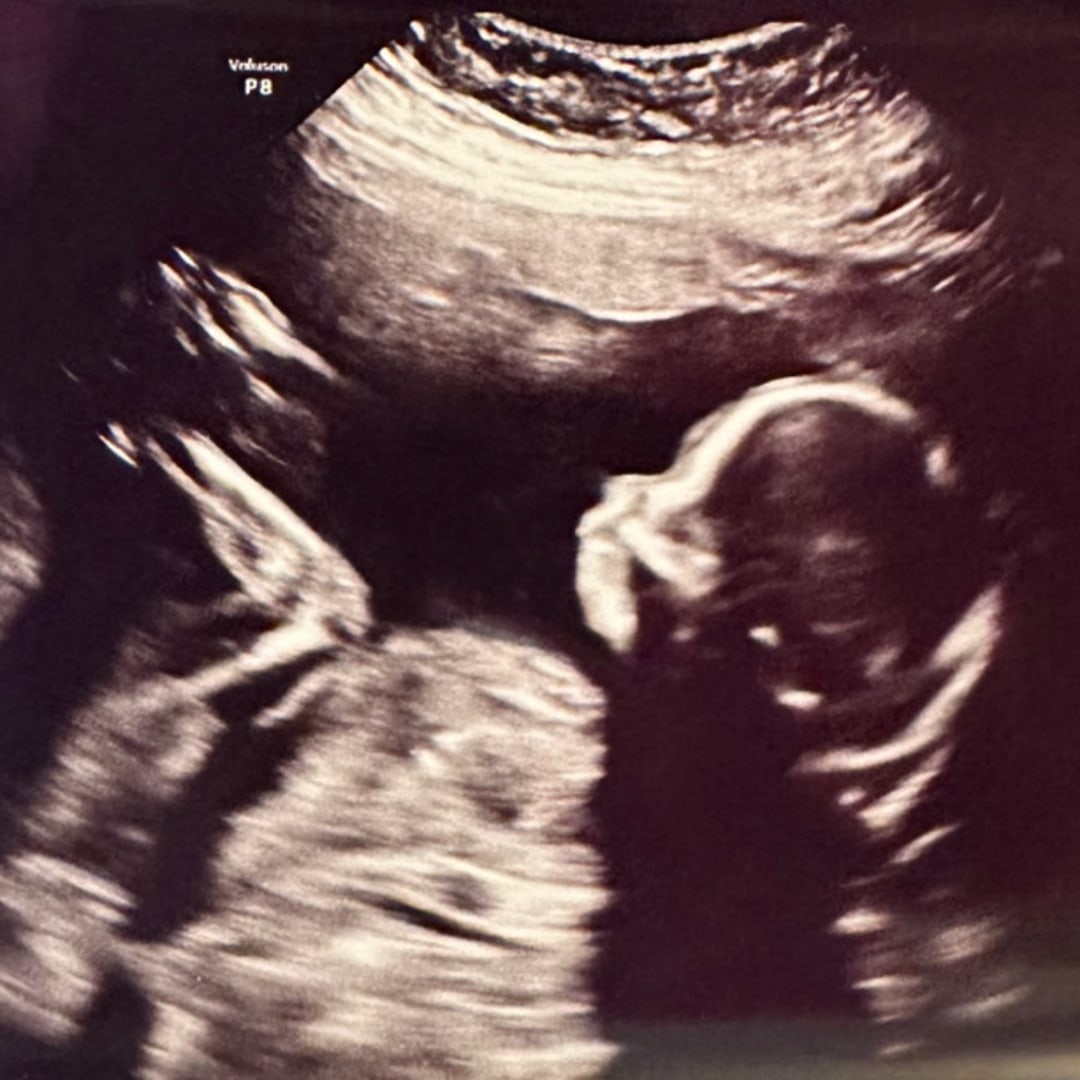 Photo shared by Niki for their Babylist baby registry.